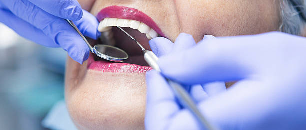 Best Emergency Tooth Extraction in Herriman, UT